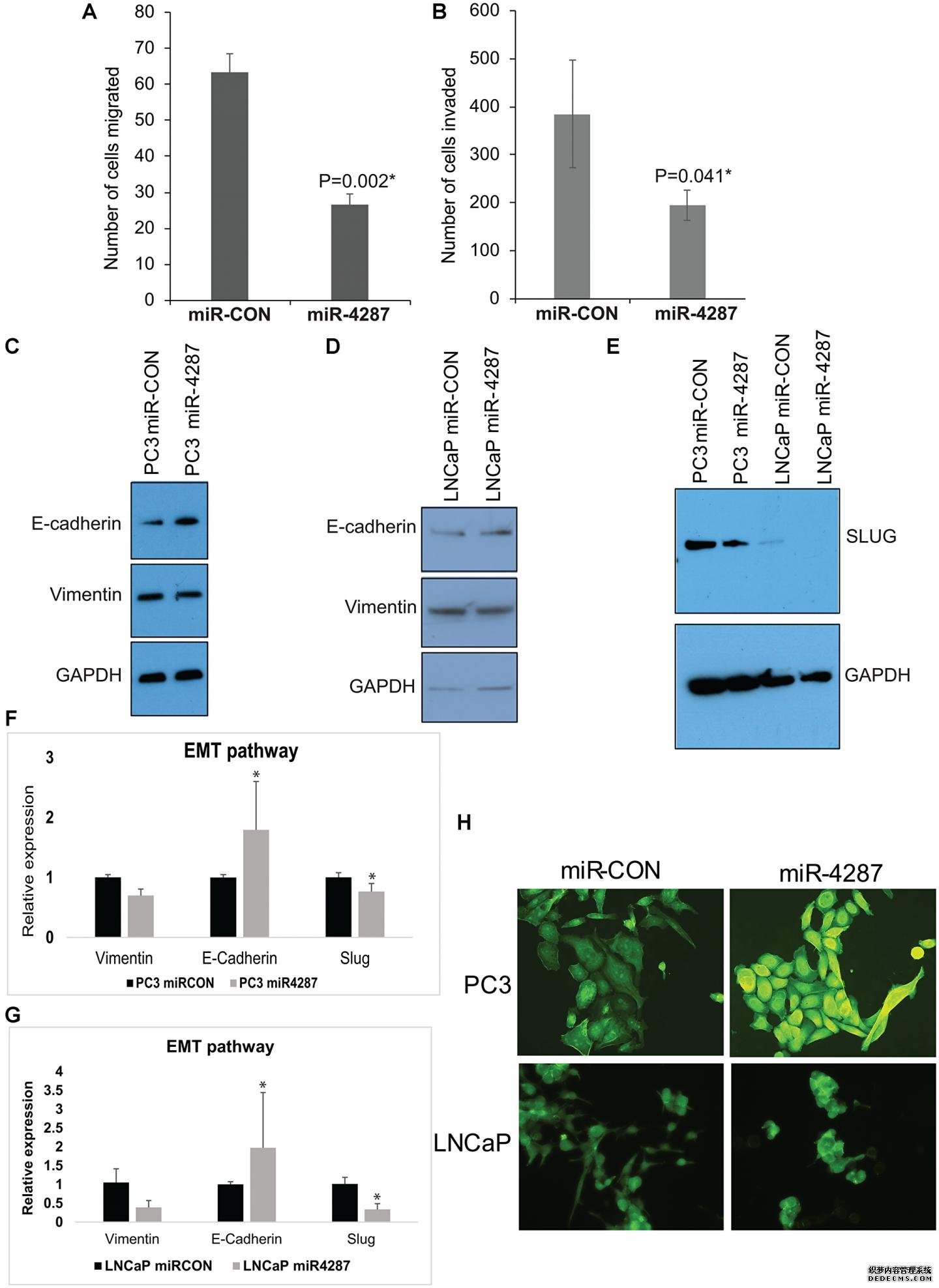 致癌靶杏耀网站点:MicroRNA-4287在前列腺癌中控制上皮细胞向间质转化